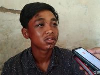 Nasib Miris Saguwanto Jadi Korban Kanjuruhan, Wajah Melepuh-Kaki Patah