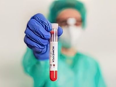 Kemenkes Benarkan Ada 42 Kasus Cacar Monyet di Indonesia