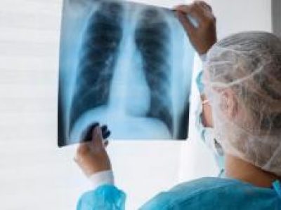 Kasus TB Tahunan di Indonesia Meningkat, Berada di Peringkat Kedua Dunia